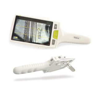 Camβ Handheld digital magnifier